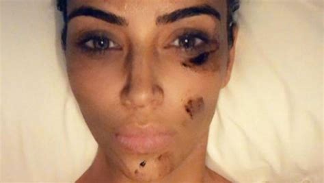 it s psoriasis kim kardashian west fires back at report about her