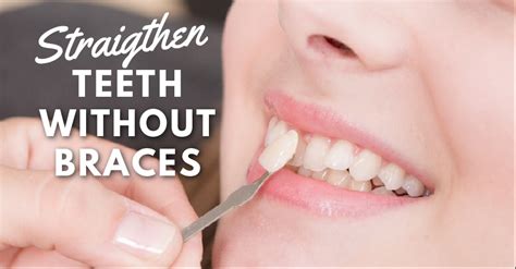 straighten teeth  braces  dental studio sg