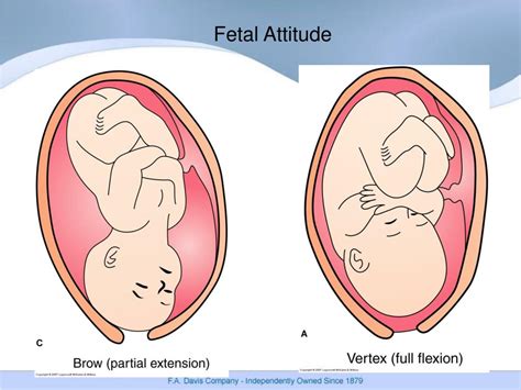 fetal   cephalic