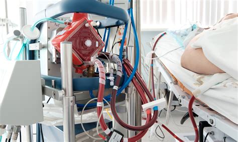 ecmo team approach improves odds  critically ill patients
