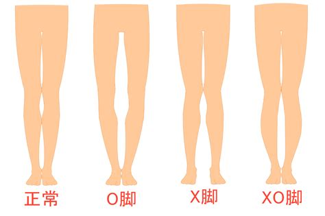 O脚の原因4選を解説！o脚矯正に役立つ歩き方やエクササイズも紹介 Tential[テンシャル] 公式オンラインストア
