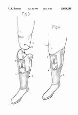 Prosthesis Lower Patents Drawing Extremity sketch template