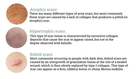 Working With Scars