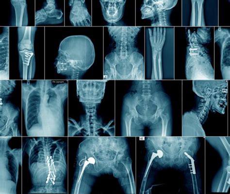 transforming radiology   operation health awareness