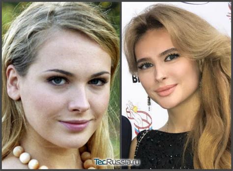 Анна Горшкова до и после пластики фото и все операции знаменитой актрисы