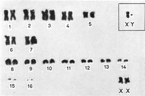 Female Karyotype Of Pipistrellus Mordax Xy Sex Chromosomes From A