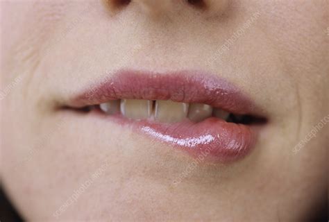 Biting Lower Lip Emoji ~ Finger On Lips Emoji Meaning Lipstutorial Org