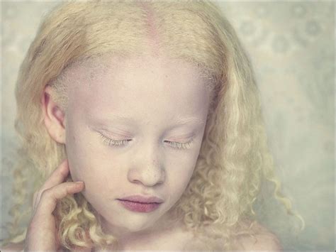 albinos project  gustavo lacerda