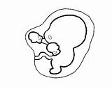 Fetus Coloring Coloringcrew sketch template