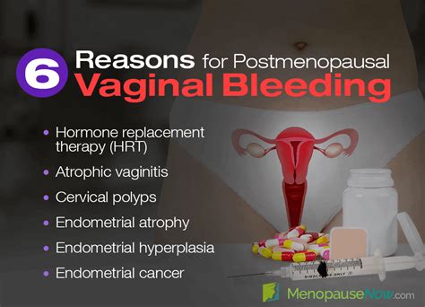 6 causes of vaginal bleeding after menopause menopause now