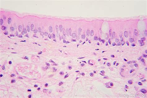 ciliated simple columnar epithelium function img abba