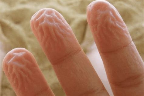 Zoeneli On Twitter If Your Fingers Dont Look Like This After