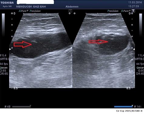 diagnostic evaluation and treatment of patients with rectus abdominis