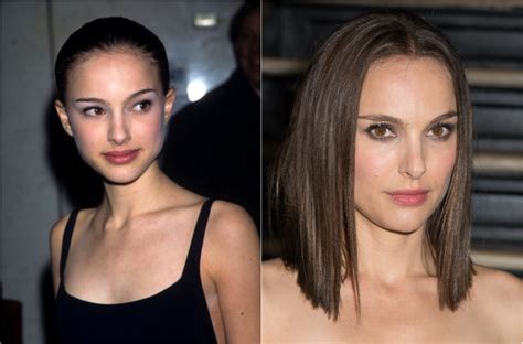 Celebrity Plastic Surgery 30 Before And After Photos
