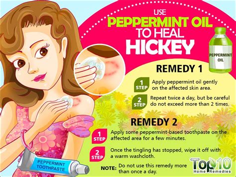 how to get rid of hickies fast top 10 home remedies