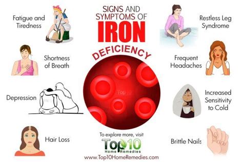 signs  symptoms  iron deficiency top  home remedies