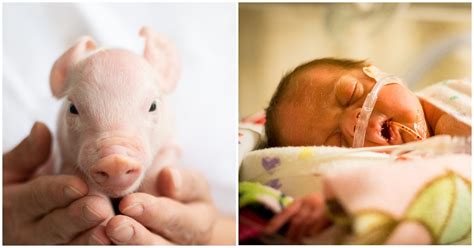 biased reuters refers  fetal pigs  babies  wont