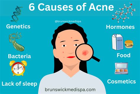 acne  acne scars treatments brunswick medi spa