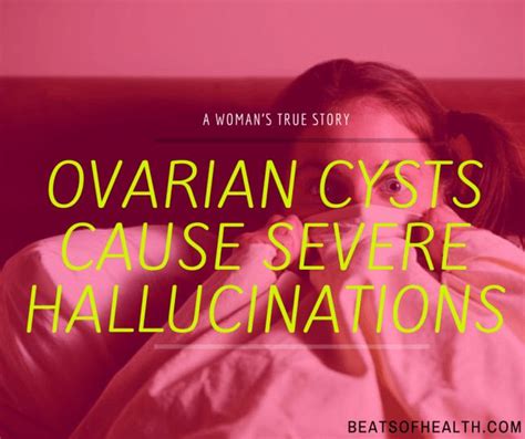 103 best ovarian cysts the best and most important facts about cysts
