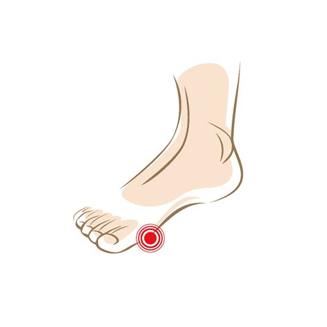 voetklachten pijnlijke voeten ontdek de oorzaak en los de pijn op