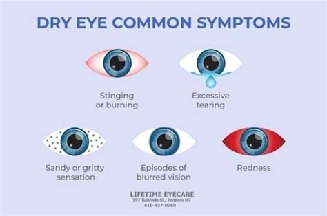 12 Most Common Dry Eye Symptoms Optometrist Optical Shop