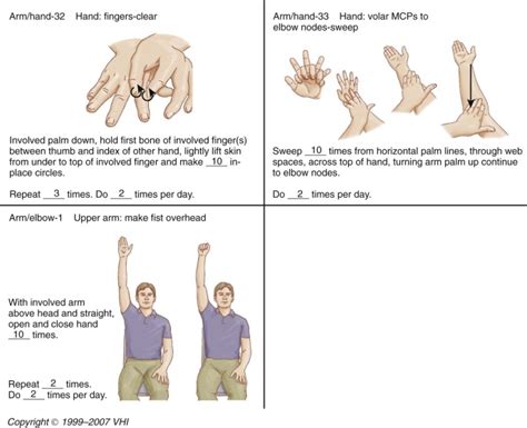 Manual Edema Mobilization An Edema Reduction Technique