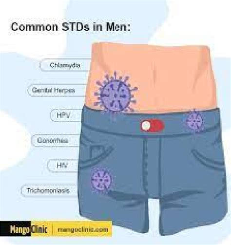 signs and symptoms of common stds in men ayv newspaper