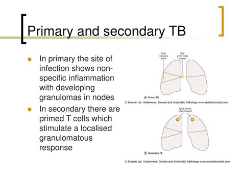respiratory infections powerpoint