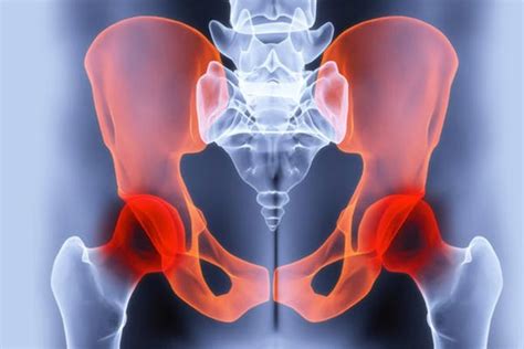 Pelvic Pain What’s The Source Of My Grief Chronic