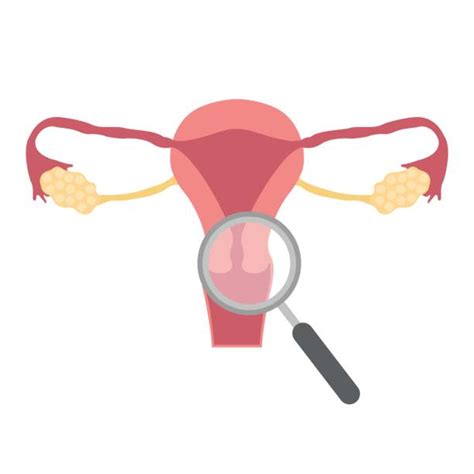 Cervix Illustrations Royalty Free Vector Graphics And Clip Art Istock