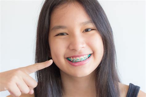 How To Brush Your Teeth With Braces Bliss Dental And Orthodontics Tx
