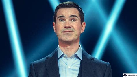 jimmy carr hair transplant   good result  quickly