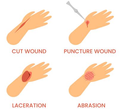 learn  lacerations  mro