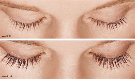lash growth product  prematurely aging  eyes dr kenneth