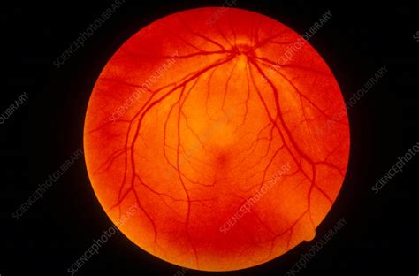 retina stock image  science photo library