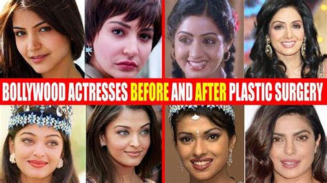 Shocking Plastic Surgery Of Bollywood Actresses Before
