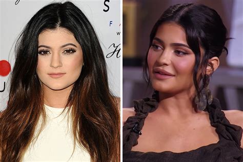 Kylie Jenner 23 Accused Of Getting Too Much Filler In Her Face