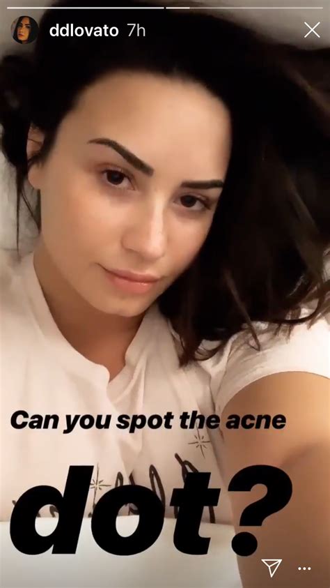 demi lovato just posted a no makeup selfie showing off her acne