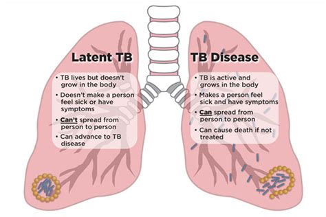 hiv  tuberculosis tb thebodycom