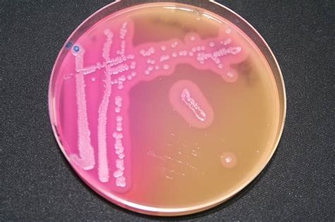 kontrollstaemmede bacillus cereus