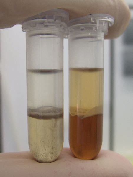 Dna Extraction Phenol Chloroform