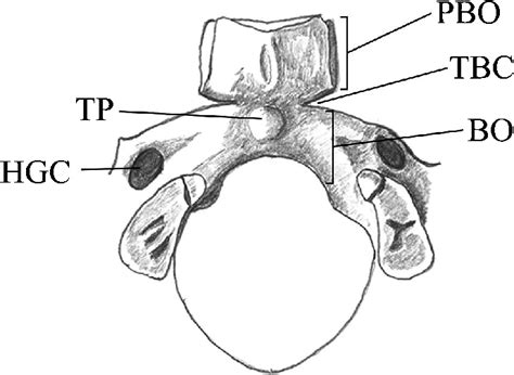 schematic illustration   basilar part   occipital bone