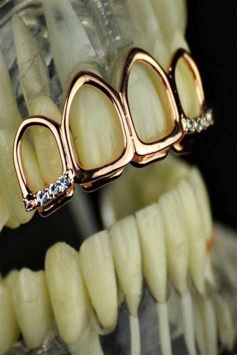 rose gold plated grillz    open face upper top teeth hip