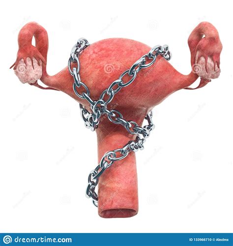 uterus disease concept human uterus with chain 3d rendering stock