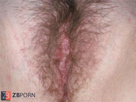 Fur Covered Vulva Zb Porn