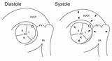 Coronary Anomalous Artery Sinus Rca Subtypes Importance sketch template