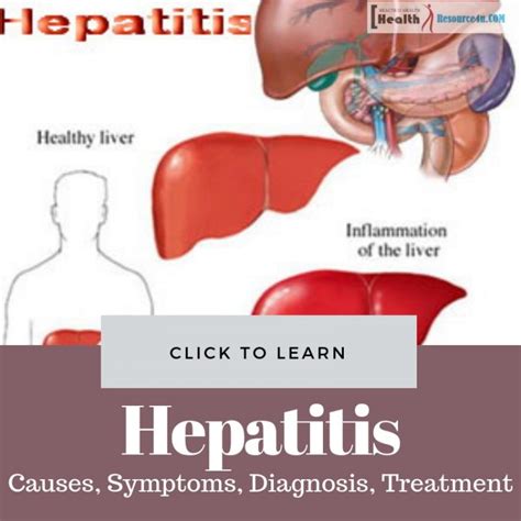 Hepatitis Causes Symptoms Diagnosis And Treatment