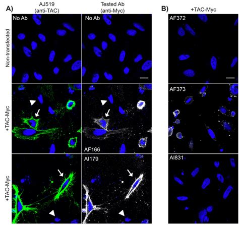 af  ai antibodies recognize  myc tagged recombinant protein  immunofluorescence