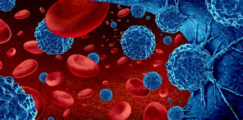patients  multiple myeloma boost  immunity cancer