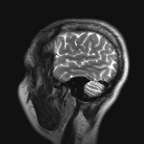 neuroimaging gifs find share  giphy